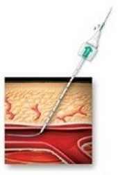 Image of  ANGIO-SEAL® VIP Vascular Closure Device