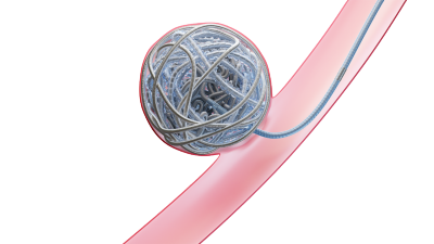 Image of Hydropack in an aneurysm